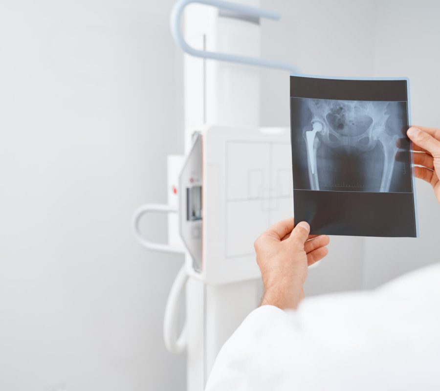 Crop of doctor holding by hands scan after ultrasound diagnostic of pelvis and hip bone. Male radiologist wearing white uniform looking on results of procedure. Concept of modern hospital.